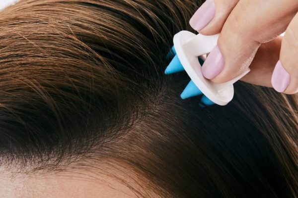 10 Tips Menjaga Kesehatan Kulit Kepala untuk Rambut Sehat
