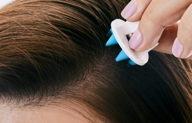 10 Tips Menjaga Kesehatan Kulit Kepala untuk Rambut Sehat