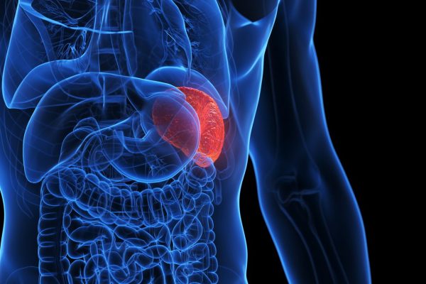 10 Langkah Sederhana agar Limpa Tidak Mudah Terserang Infeksi 10 Langkah Sederhana agar Limpa Tidak Mudah Terserang Infeksi