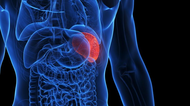 10 Langkah Sederhana agar Limpa Tidak Mudah Terserang Infeksi