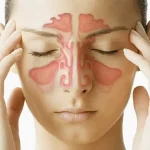 10 Tips Mencegah Sinusitis Kambuh