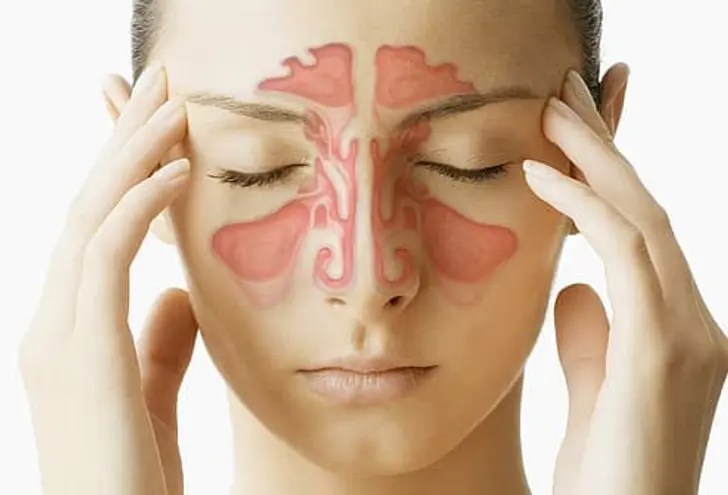 10 Tips Mencegah Sinusitis Kambuh