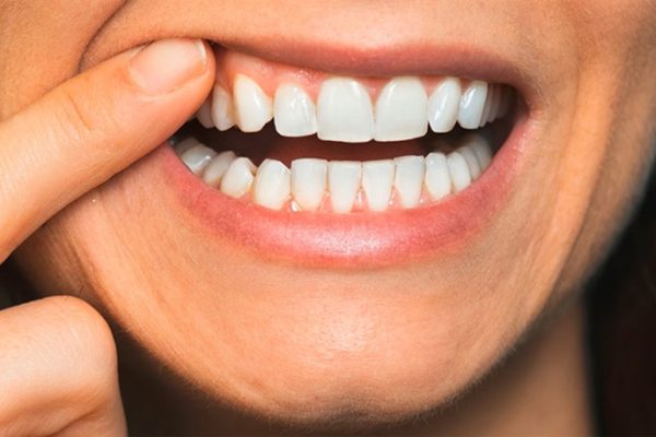 10 Kebiasaan Sehat agar Gigi Tetap Kuat Sepanjang Usia 10 Kebiasaan Sehat agar Gigi Tetap Kuat Sepanjang Usia