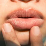 10 Hal yang Harus Dihindari agar Bibir Tidak Kering
