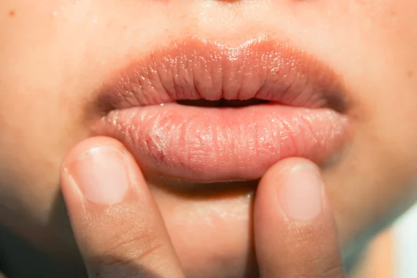 10 Hal yang Harus Dihindari agar Bibir Tidak Kering