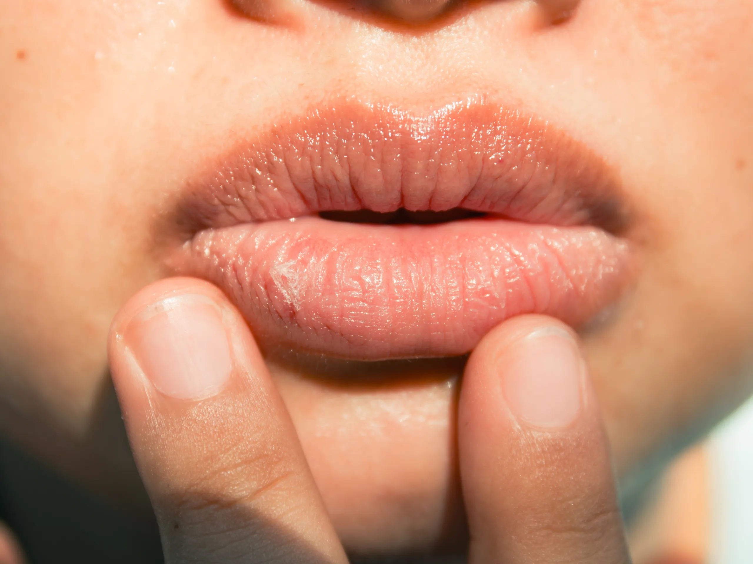 10 Hal yang Harus Dihindari agar Bibir Tidak Kering